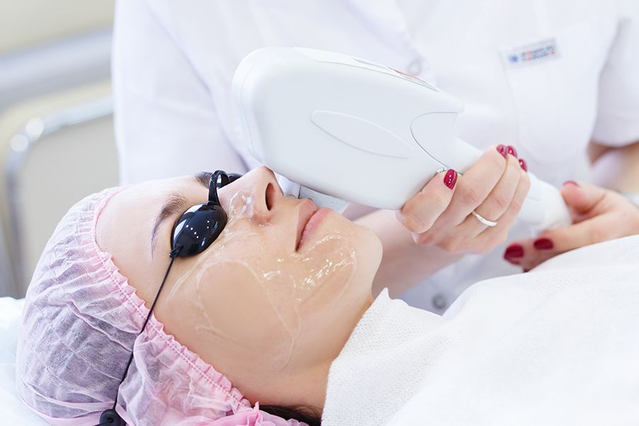 skin laser treatment Delhi